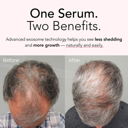 whatskin™ exosome - goodbye damaged skin!